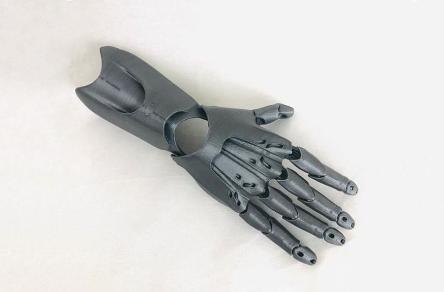 ProstheticHand