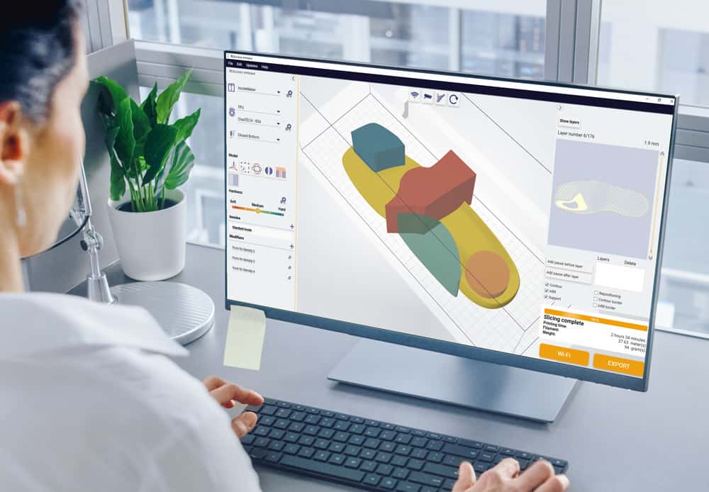 Embrace-realvision-slicer-screen