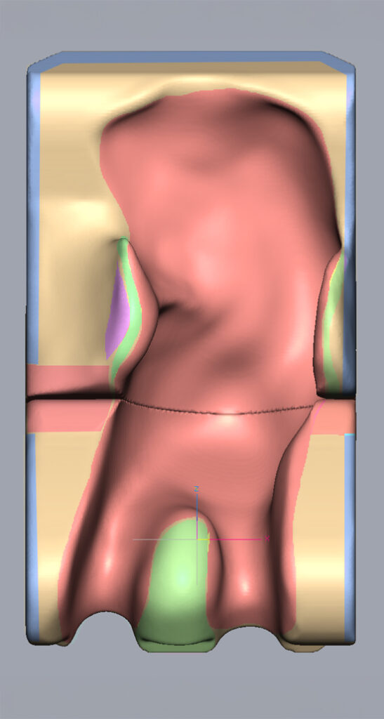 3D scan of wheelchair seat