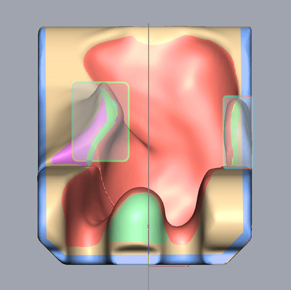 3D scan of wheelchair seat