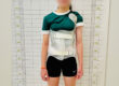 scoliosis brace