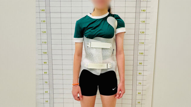 scoliosis case wide scoliosis brace