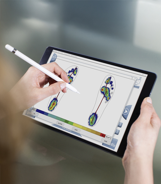 Scan of feet for 3D printed insoles