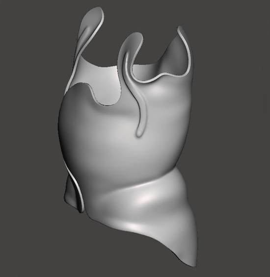 3D printed brace model