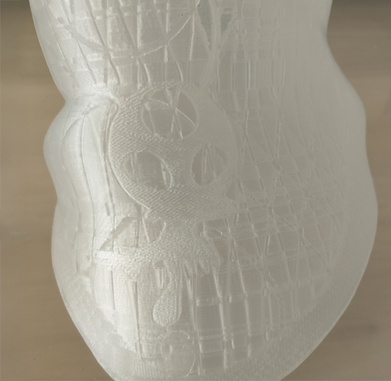 The future brace design