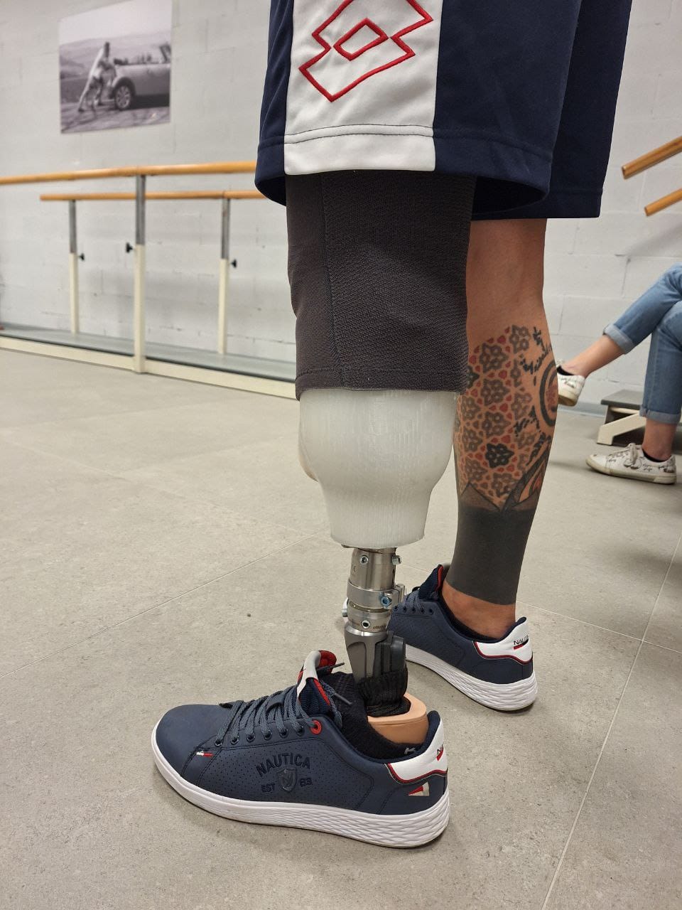 Prosthetic socket on client