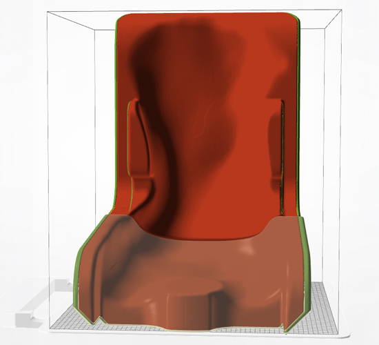 Complex seating orthosis